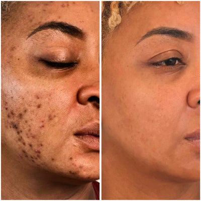 Dark Spot Brightening Cleansing Pad