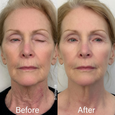Naima Neck Masks