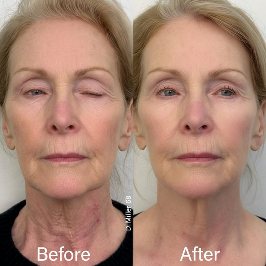 Naima Neck Masks