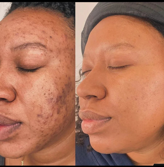 Dark Spot Brightening Cleansing Pad
