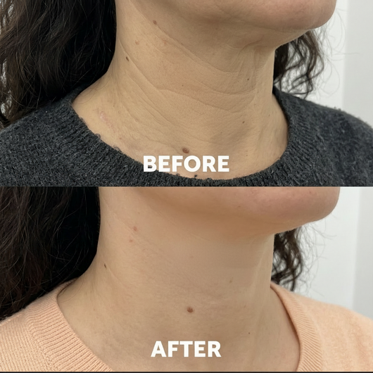 Naima Neck Masks