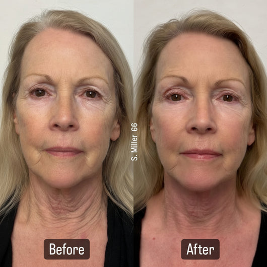 Naima Neck Masks