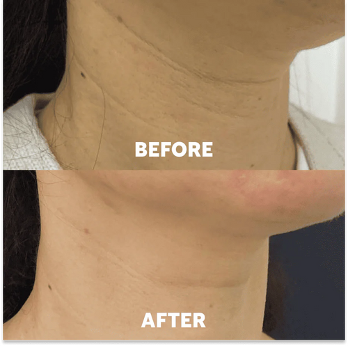 Naima Neck Masks