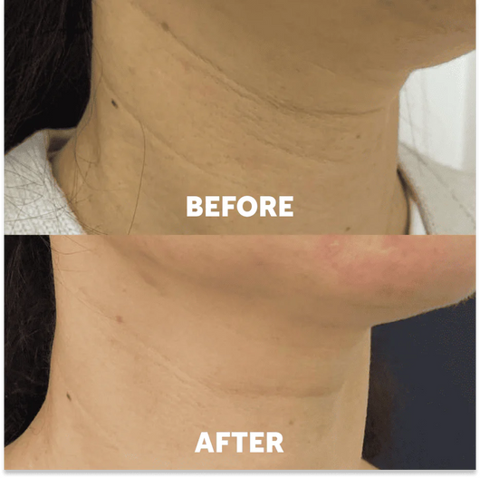 Naima Neck Masks